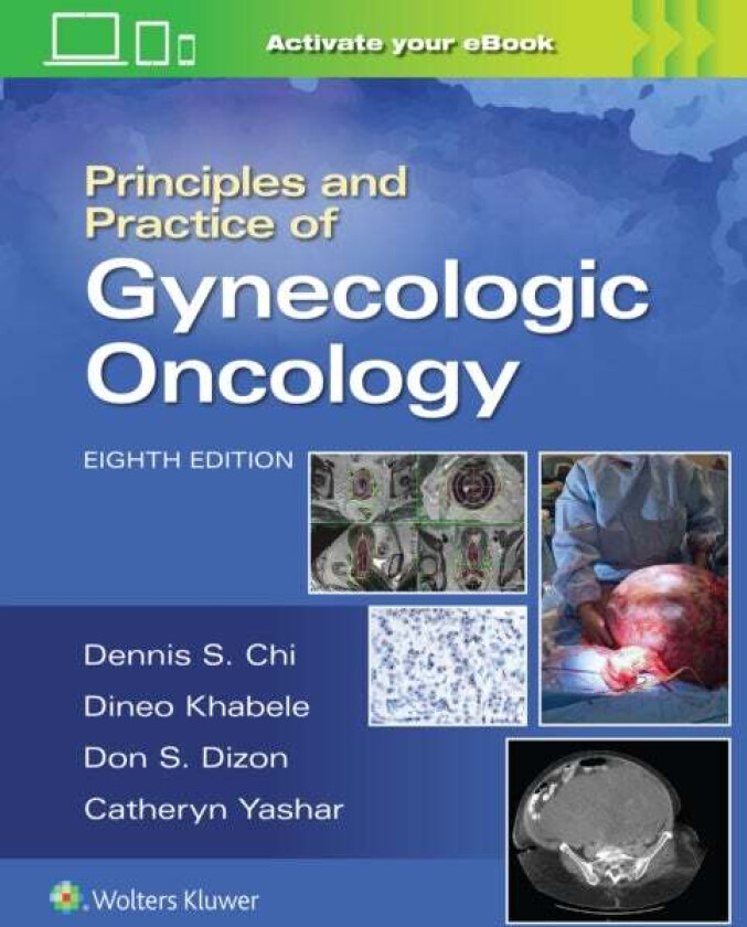 Principles and Practice of Gynecologic Oncology av DENNIS CHI, Andrew Berchuck, Don S. Dizon, Catheryn M. Yashar