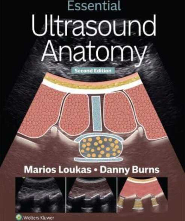 Essential Ultrasound Anatomy