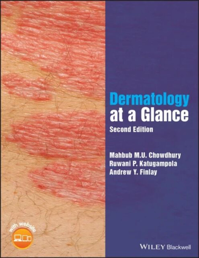 Dermatology at a Glance av Mahbub M. U. (University Hospital of Wales Cardiff) Chowdhury, Ruwani P. (University Hospital of Wales Cardiff) Katugampola