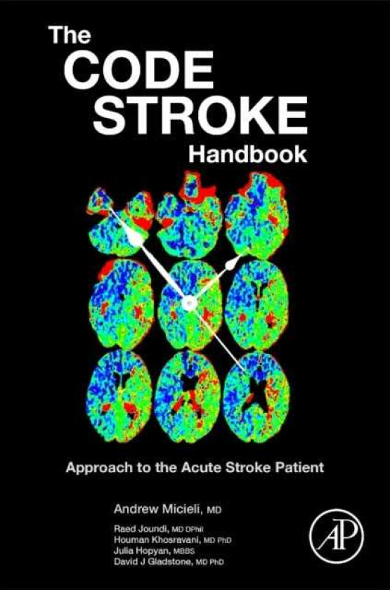 The Code Stroke Handbook Approach to the Acute Stroke Patient