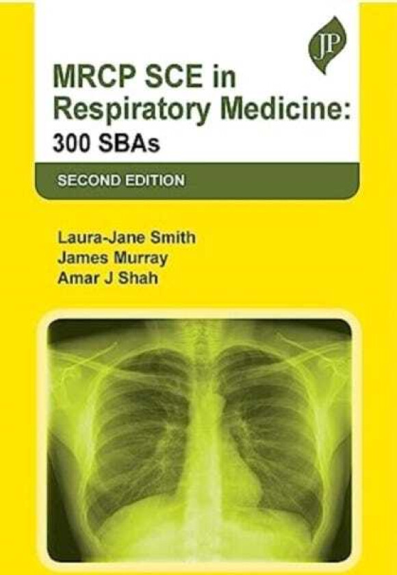 MRCP SCE in Respiratory Medicine 300 SBAs