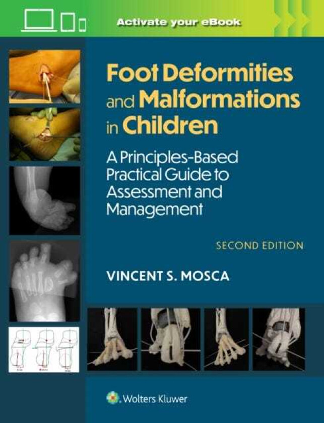 Bilde av Foot Deformities and Malformations in Children A PrinciplesBased, Practical Guide to Assessment and Management: Print + eBook with Multimedia