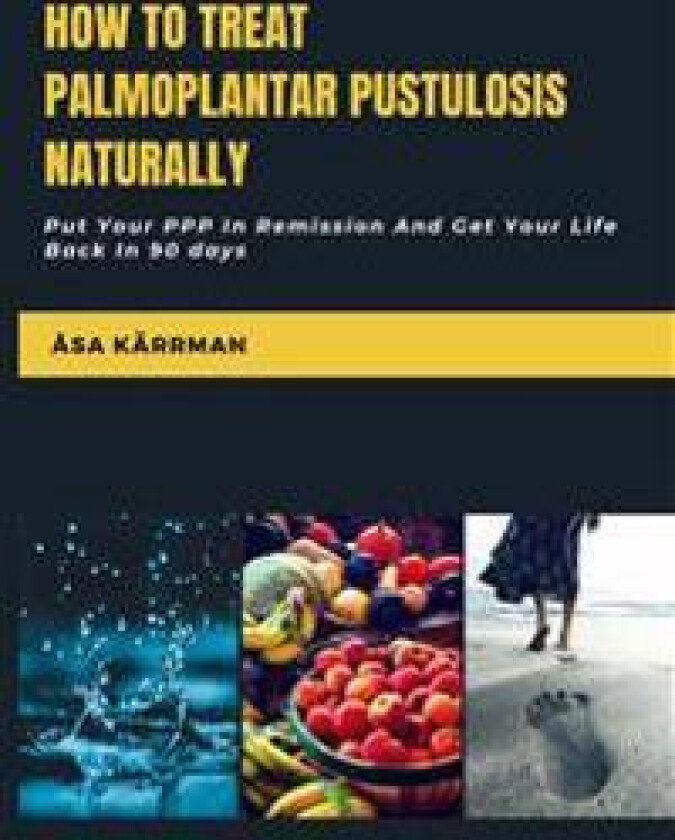 How To Treat Palmoplantar Pustulosis Naturally