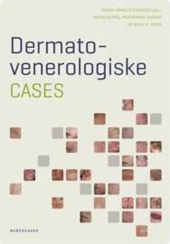 Dermato- venerologiske cases