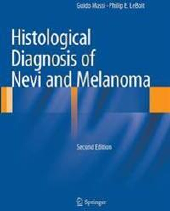 Histological Diagnosis of Nevi and Melanoma
