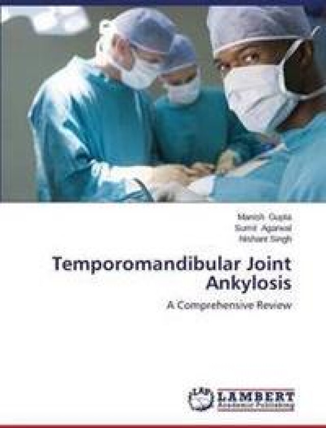 Temporomandibular Joint Ankylosis
