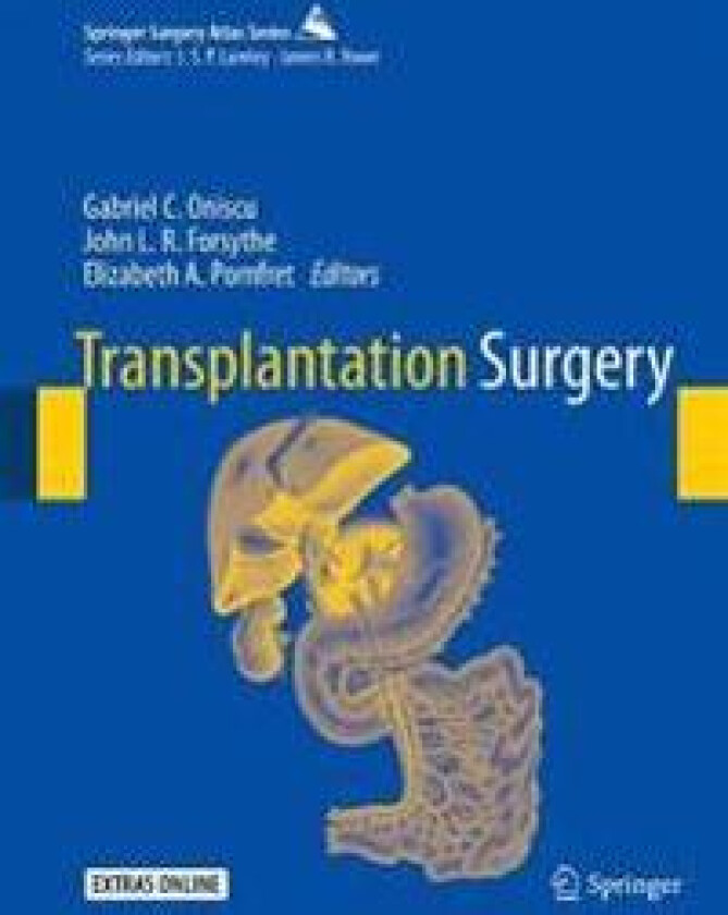 Transplantation Surgery
