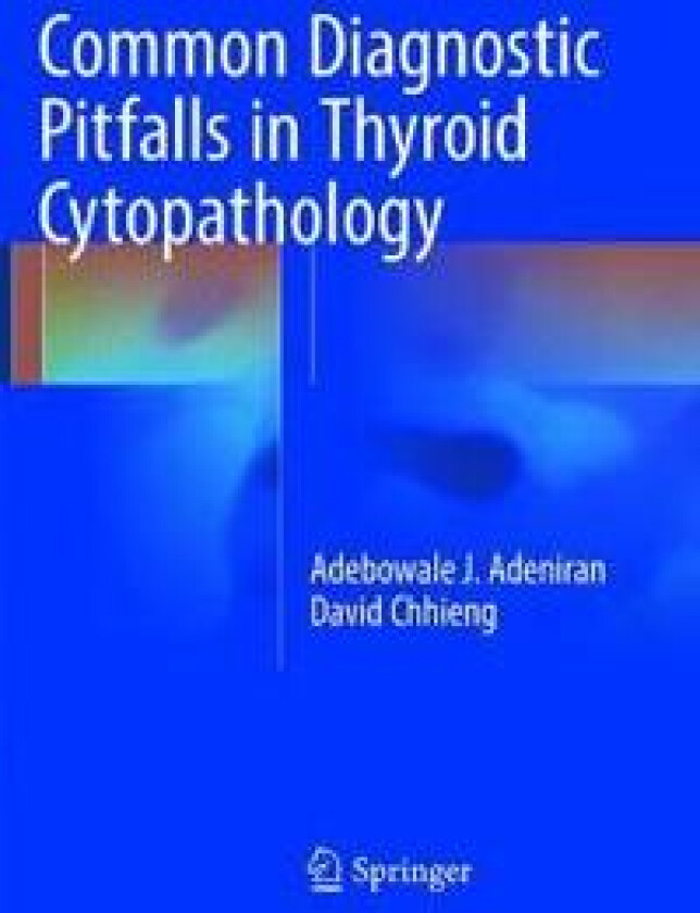 Common Diagnostic Pitfalls in Thyroid Cytopathology