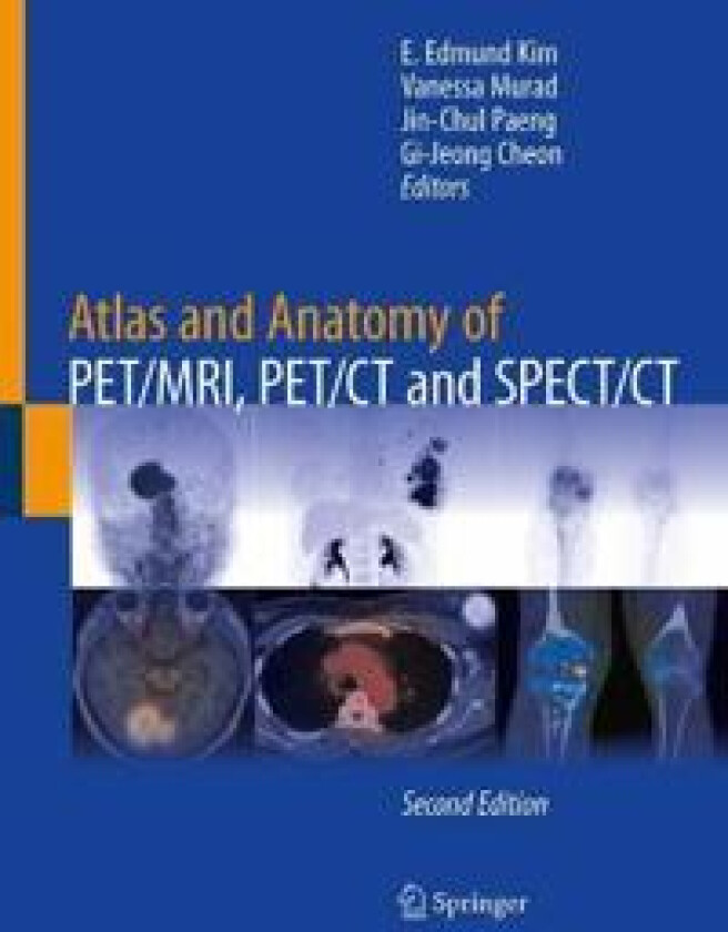 Atlas and Anatomy of PET/MRI, PET/CT and SPECT/CT