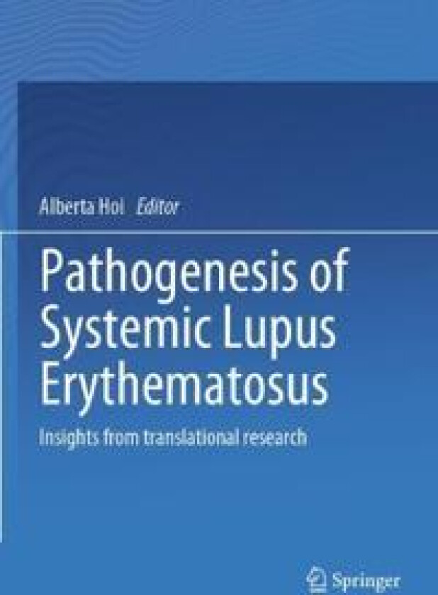 Pathogenesis of Systemic Lupus Erythematosus