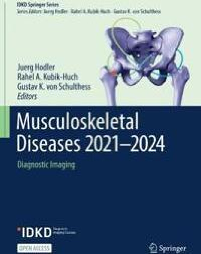 Musculoskeletal Diseases 2021-2024