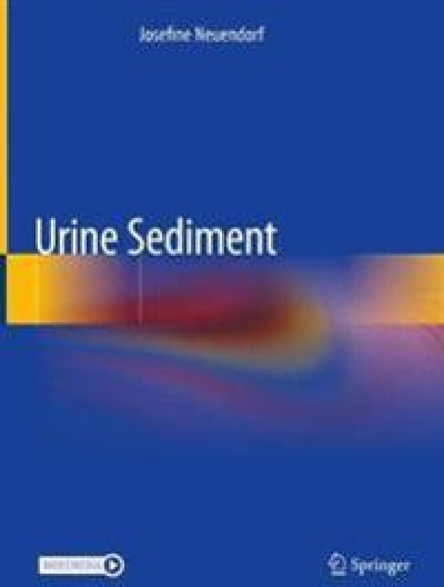 Urine Sediment