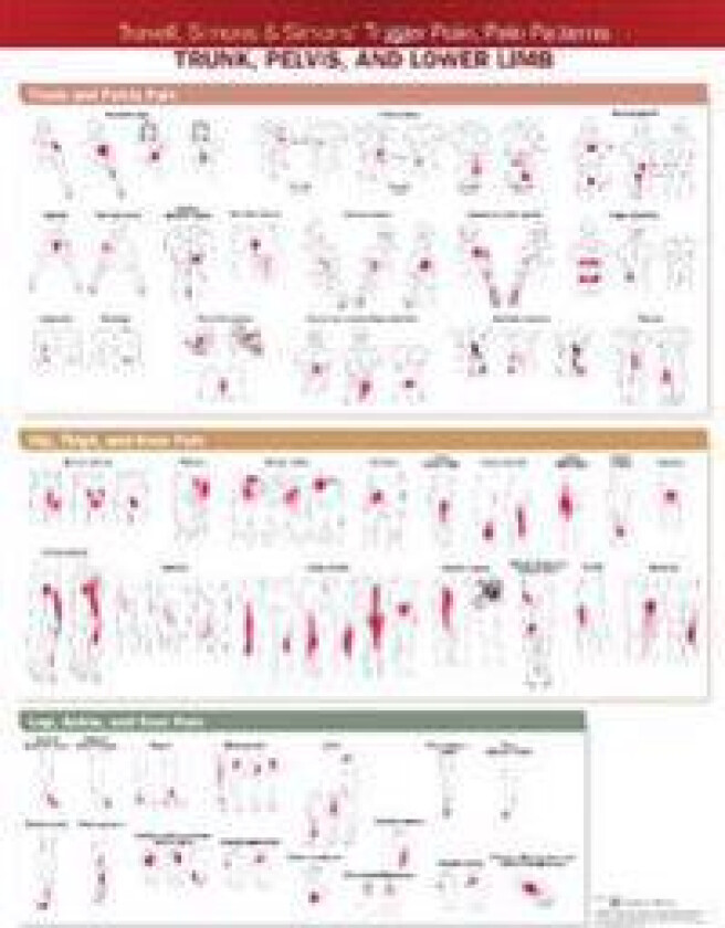 Travell, Simons & Simons’ Trigger Point Pain Patterns Wall Chart