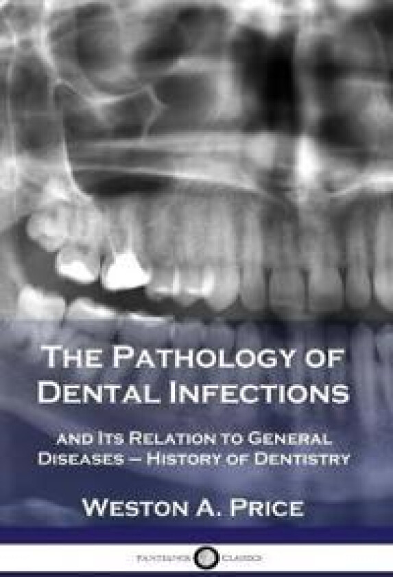The Pathology of Dental Infections
