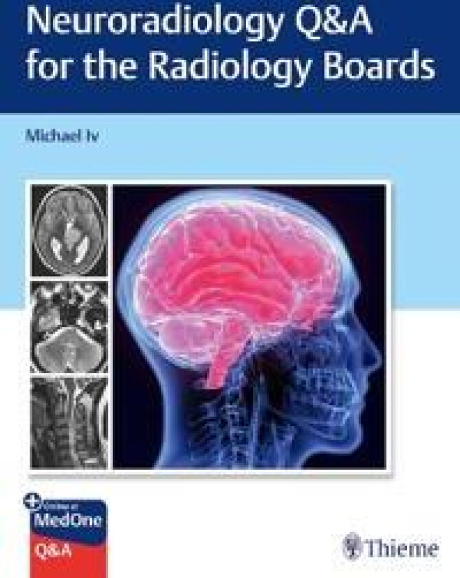 Neuroradiology Q&A for the Radiology Boards