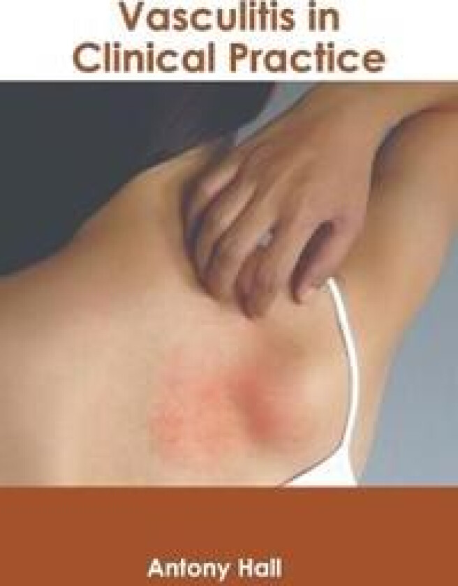 Vasculitis in Clinical Practice