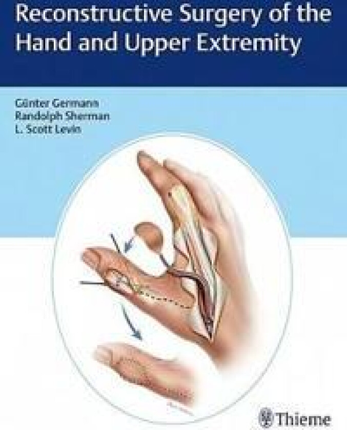 Reconstructive Surgery of the Hand and Upper Extremity