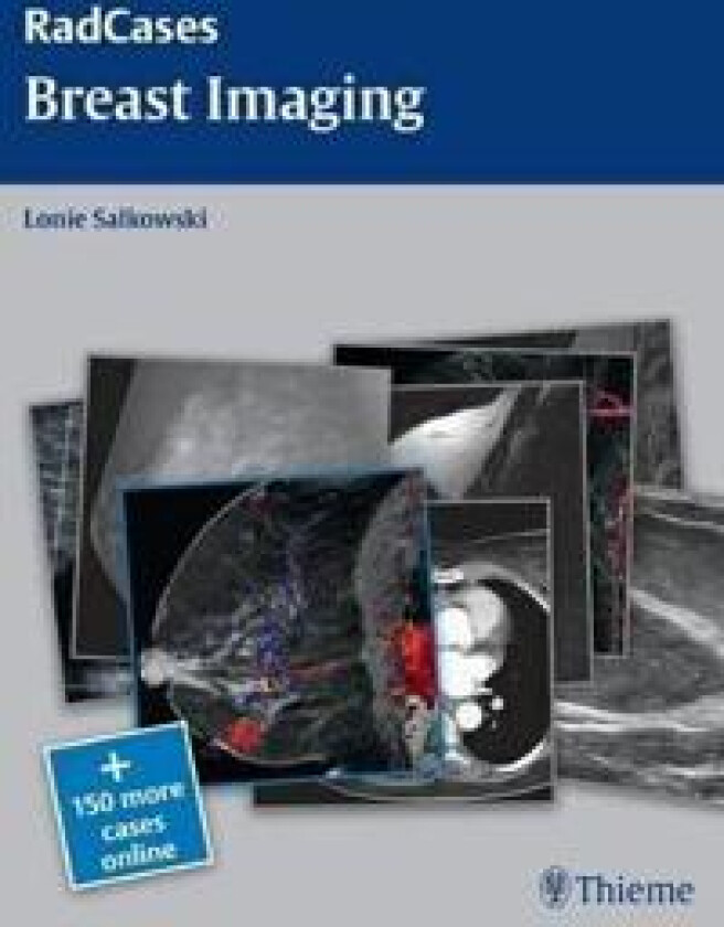 Radcases Breast Imaging