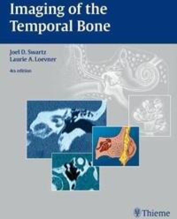 Imaging of the Temporal Bone