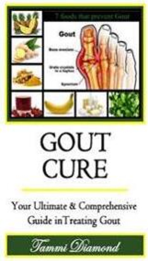 Gout Cure: Your Ultimate and Comprehensive Guide in Treating Gout