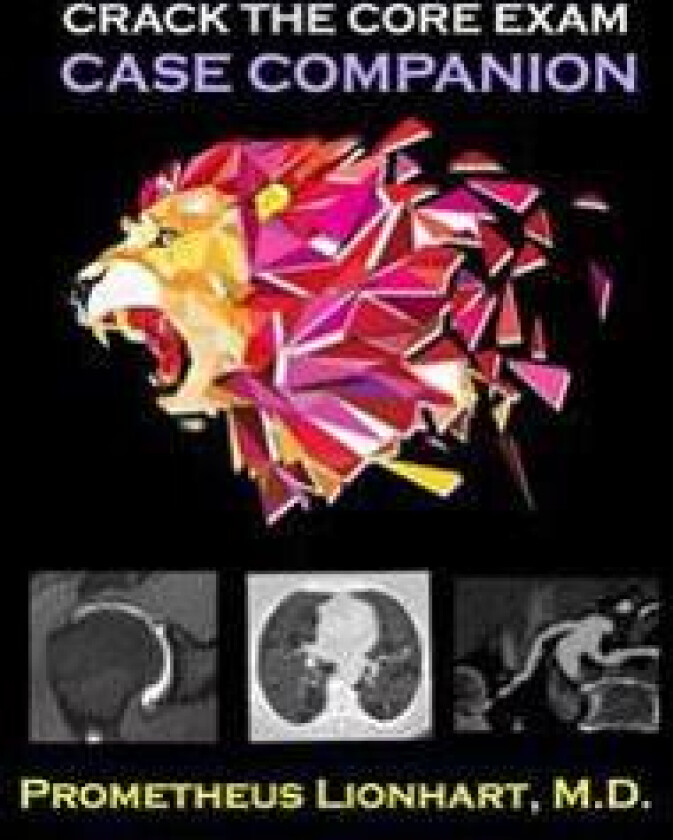 Crack the Core Exam - Case Companion