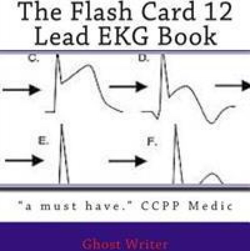 The Flash Card 12 Lead EKG