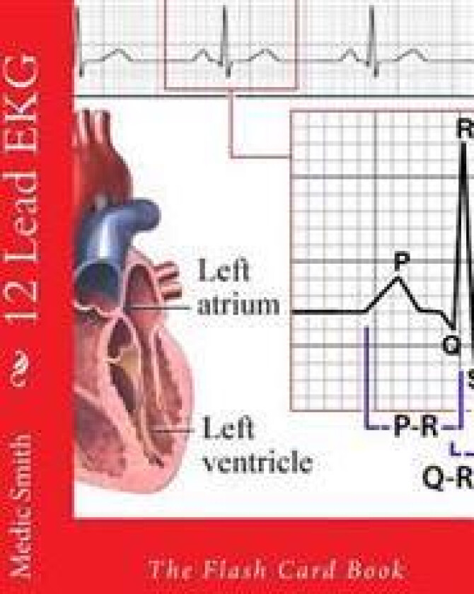 12 Lead EKG: The Flash Card Book