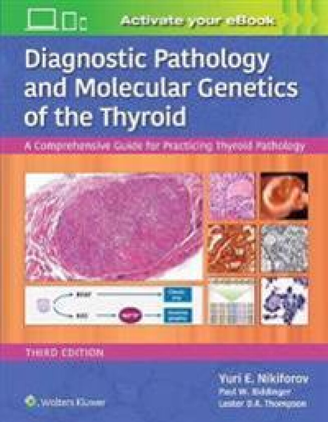 Bilde av Diagnostic Pathology and Molecular Genetics of the Thyroid