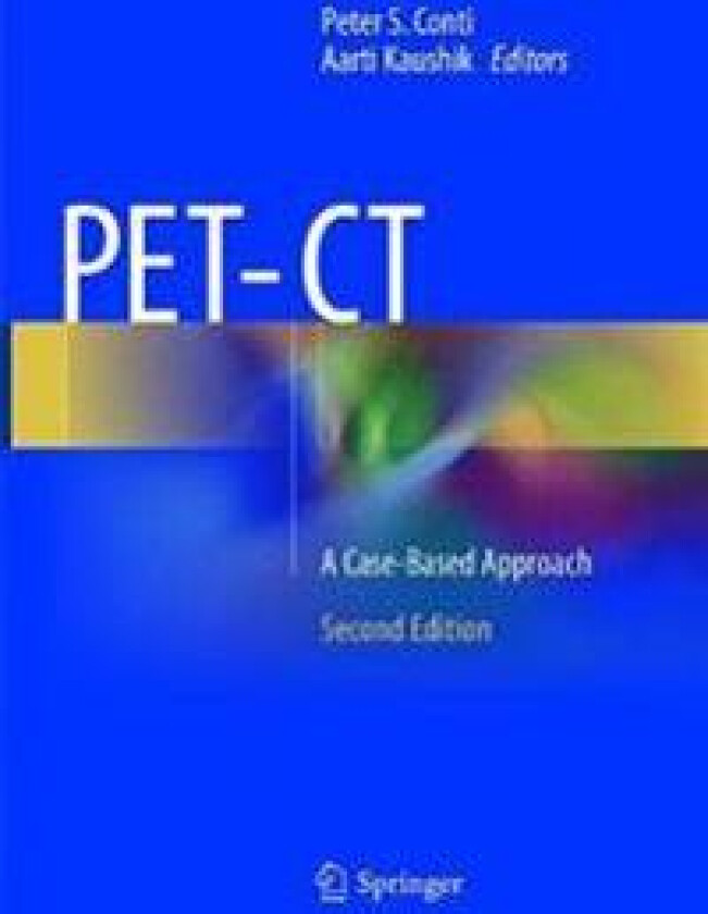 PET-CT