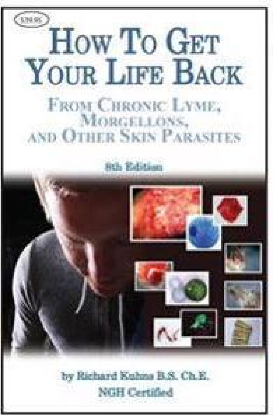 How to Get Your Life Back From Morgellons and Other Skin Parasites Limited Edit