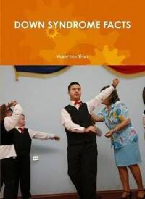 Down Syndrome Facts