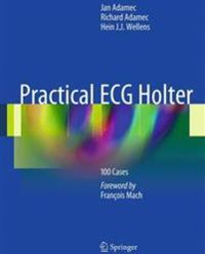 Practical ECG Holter