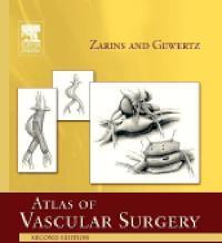 Atlas Of Vascular Surgery - Paperback Edition