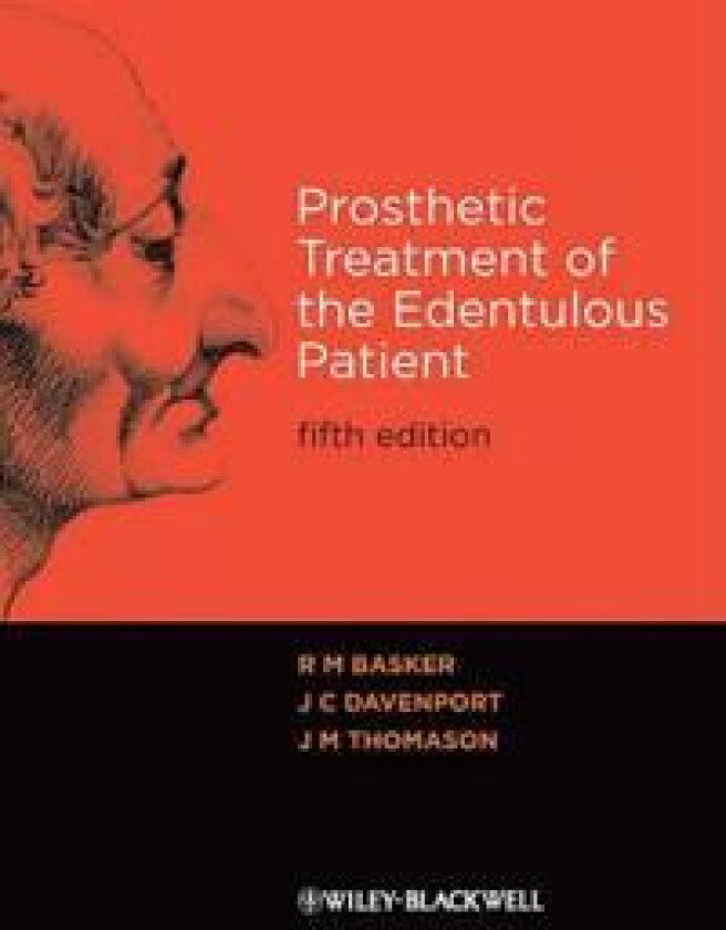 Prosthetic Treatment of the Edentulous Patient