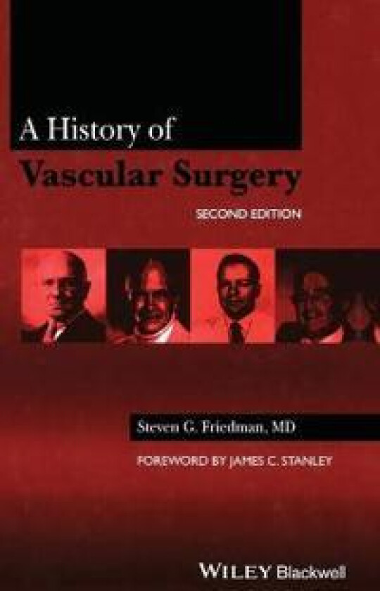 A History of Vascular Surgery