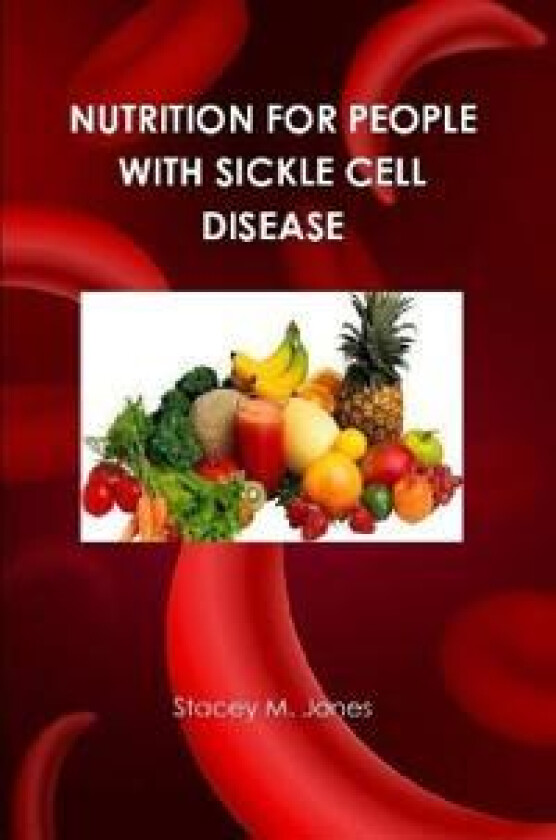 Nutrition for people with Sickle Cell Disease