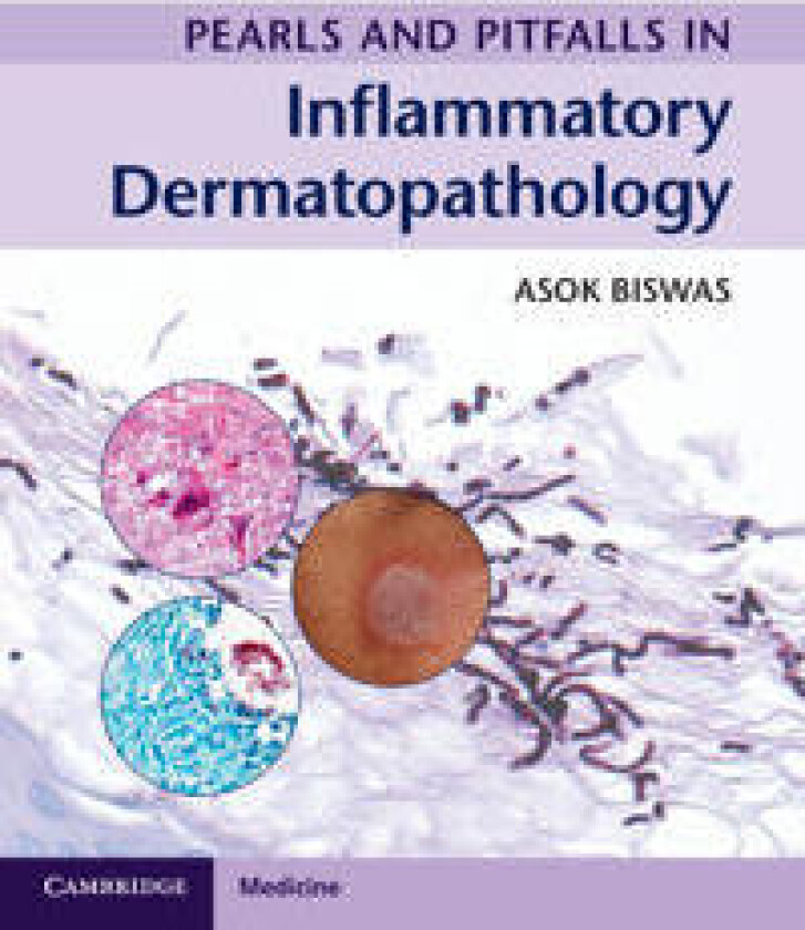 Bilde av Pearls and Pitfalls in Inflammatory Dermatopathology