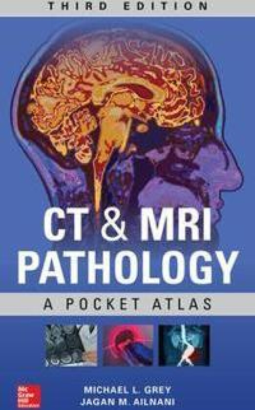 CT & MRI Pathology: A Pocket Atlas, Third Edition
