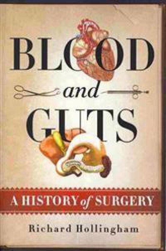 Blood and Guts: A History of Surgery
