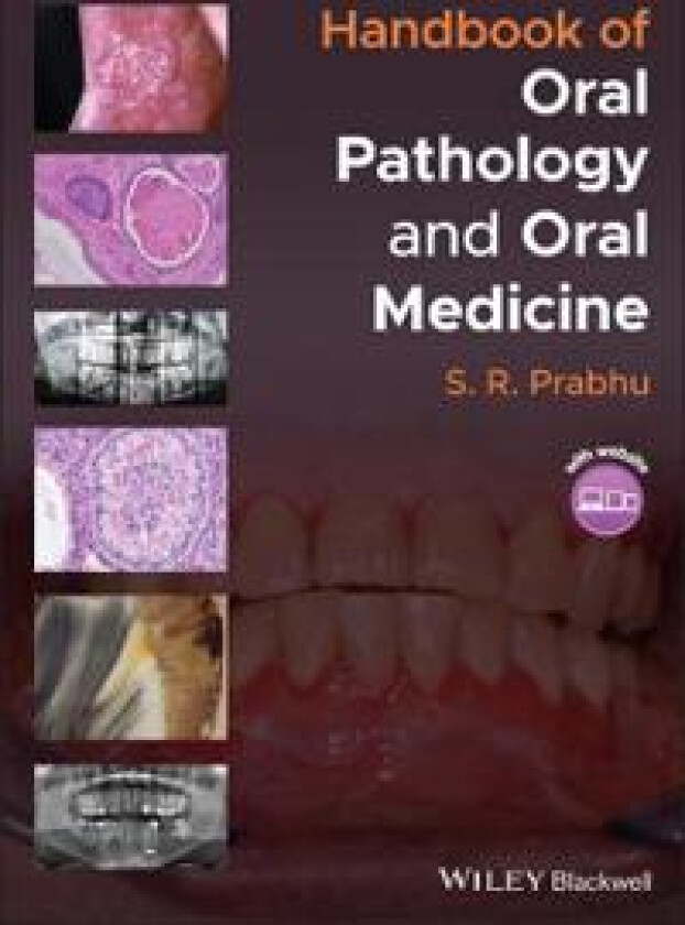 Handbook of Oral Pathology and Oral Medicine