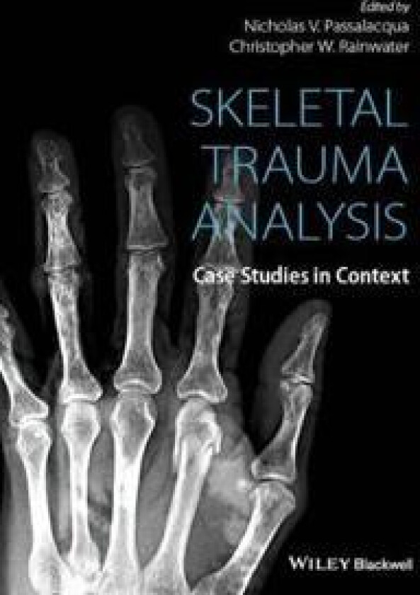 Skeletal Trauma Analysis