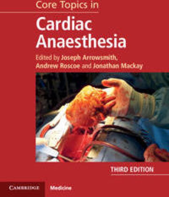 Core Topics in Cardiac Anaesthesia