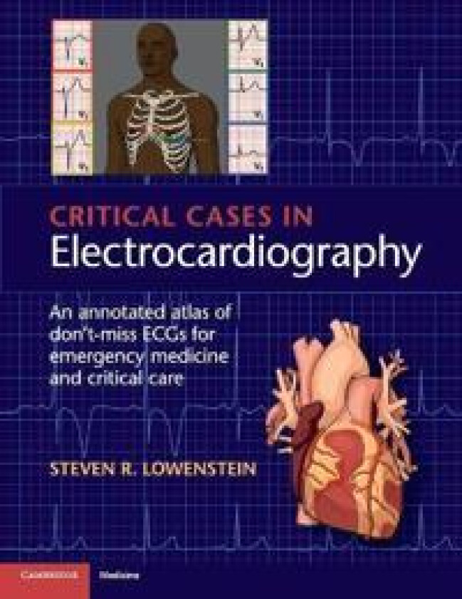 Critical Cases in Electrocardiography