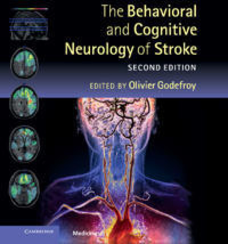 The Behavioral and Cognitive Neurology of Stroke