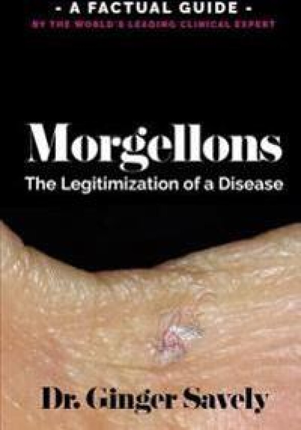 Morgellons: The legitimization of a disease: A Factual Guide by the World's Leading Clinical Expert
