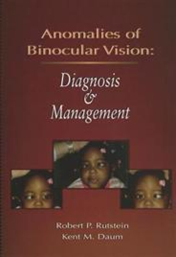 Anomalies Of Binocular Vision