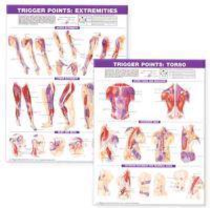 Trigger Point Chart Set: Torso & Extremities Paper