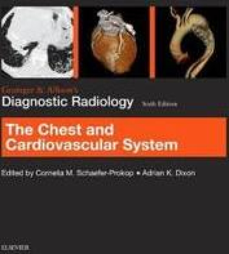 Grainger & Allison's Diagnostic Radiology: Chest and Cardiovascular System