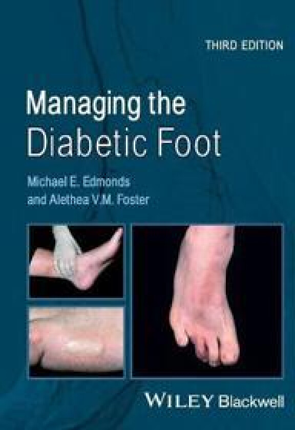 Managing the Diabetic Foot