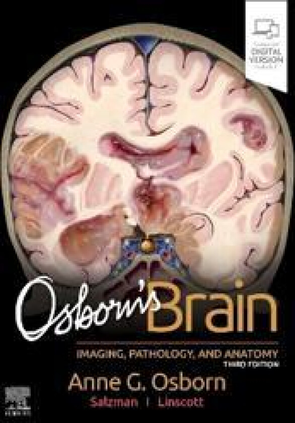Osborn's Brain
